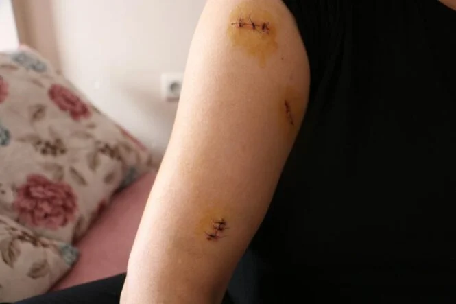 Nikahlı eşini 30 yerinden bıçakladı